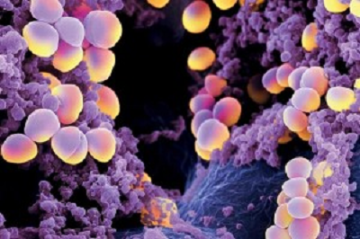 Diete per humbe pesha